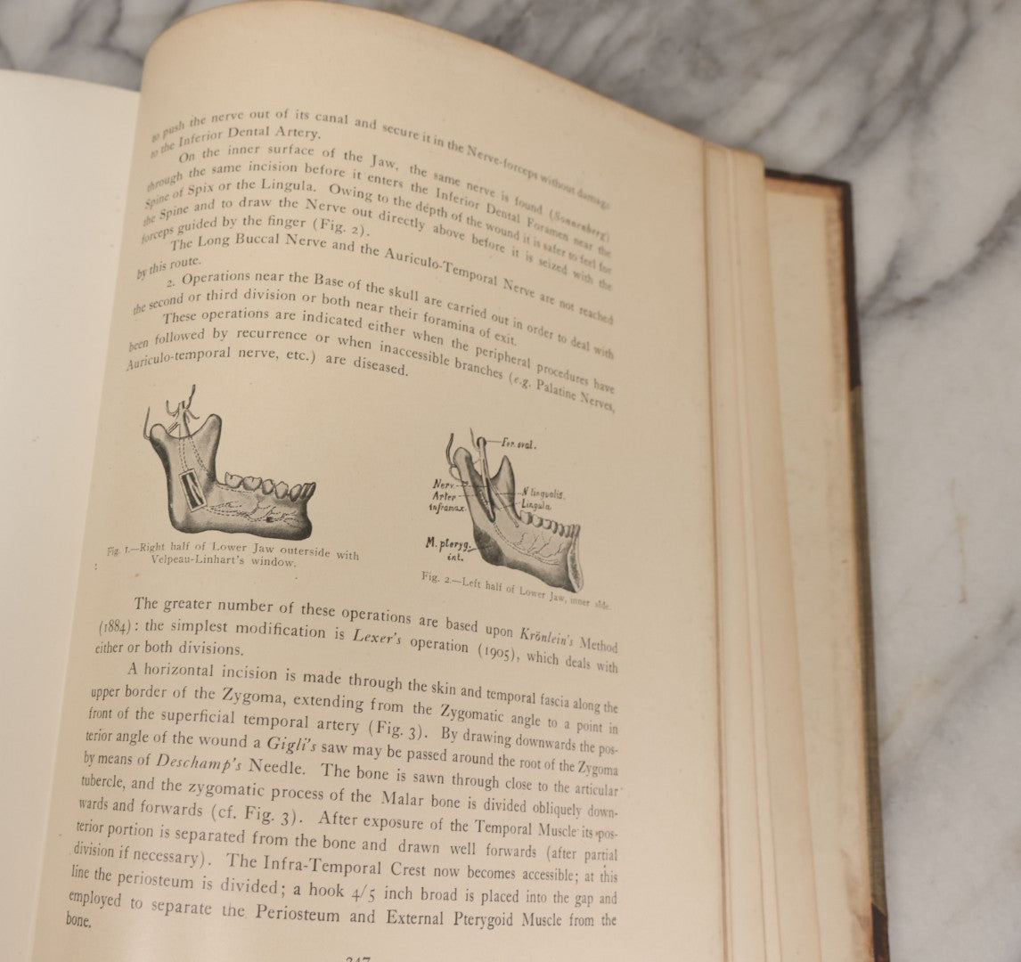 Lot 002 - "Atlas Of Typical Operations In Surgery" Antique Book By Dr. Ph. Bockenheimer & Dr. Fritz Frohse, With 60 Full Color Illustrations By Franz Frohse, English Adaptation By J. Howell Evans, Rebman Company, New York, Publishers, Circa 1900