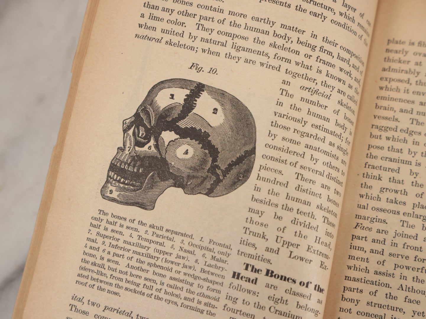 Lot 003 - "The People's Common Sense Medical Adviser In Plain English; Or Medicine Simplified" Antique Book By R.V. Pierce, M.D., 21st Edition, Illustrated, 1889