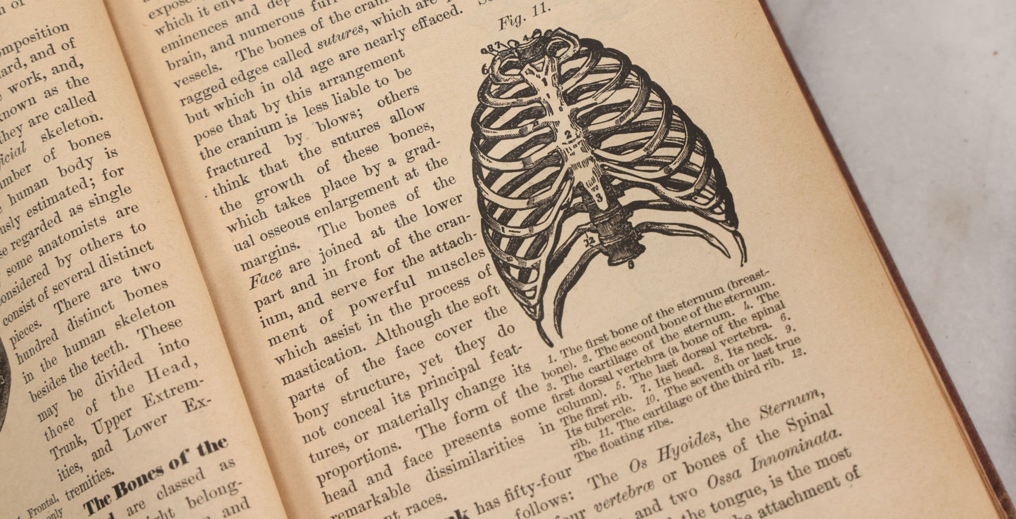 Lot 003 - "The People's Common Sense Medical Adviser In Plain English; Or Medicine Simplified" Antique Book By R.V. Pierce, M.D., 21st Edition, Illustrated, 1889