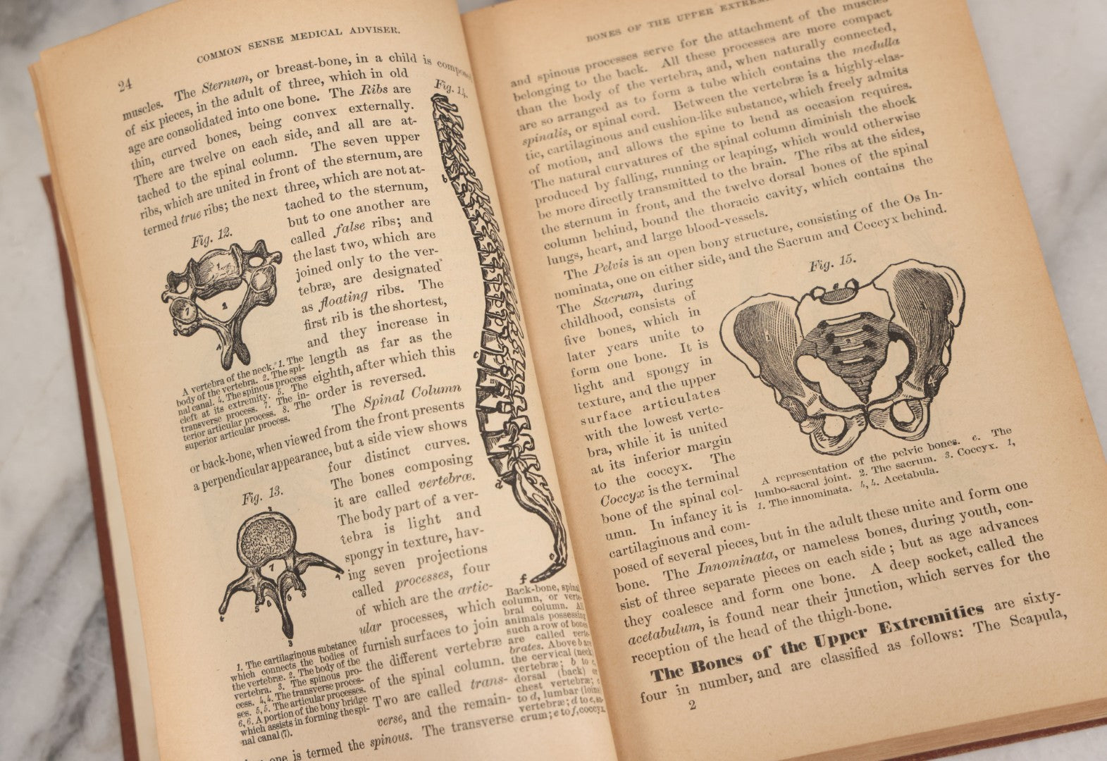 Lot 003 - "The People's Common Sense Medical Adviser In Plain English; Or Medicine Simplified" Antique Book By R.V. Pierce, M.D., 21st Edition, Illustrated, 1889