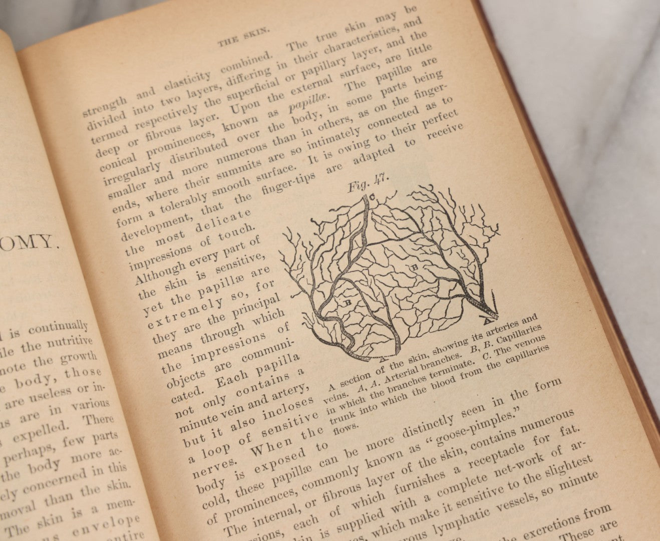 Lot 003 - "The People's Common Sense Medical Adviser In Plain English; Or Medicine Simplified" Antique Book By R.V. Pierce, M.D., 21st Edition, Illustrated, 1889