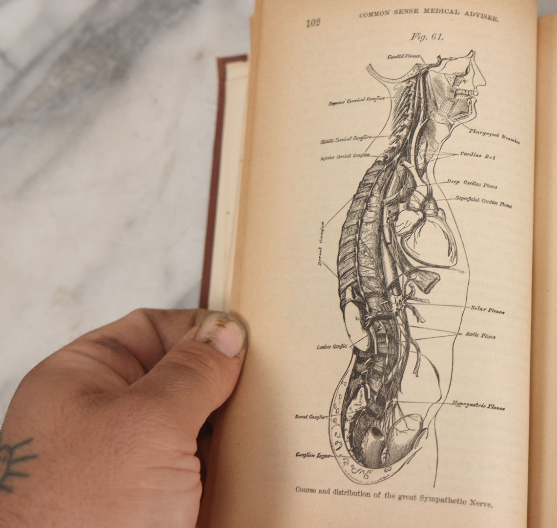 Lot 003 - "The People's Common Sense Medical Adviser In Plain English; Or Medicine Simplified" Antique Book By R.V. Pierce, M.D., 21st Edition, Illustrated, 1889