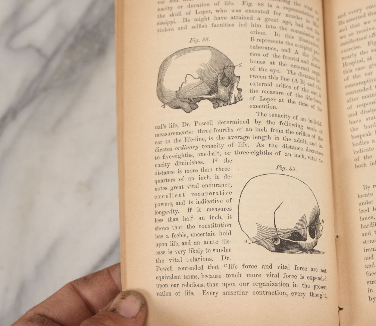 Lot 003 - "The People's Common Sense Medical Adviser In Plain English; Or Medicine Simplified" Antique Book By R.V. Pierce, M.D., 21st Edition, Illustrated, 1889