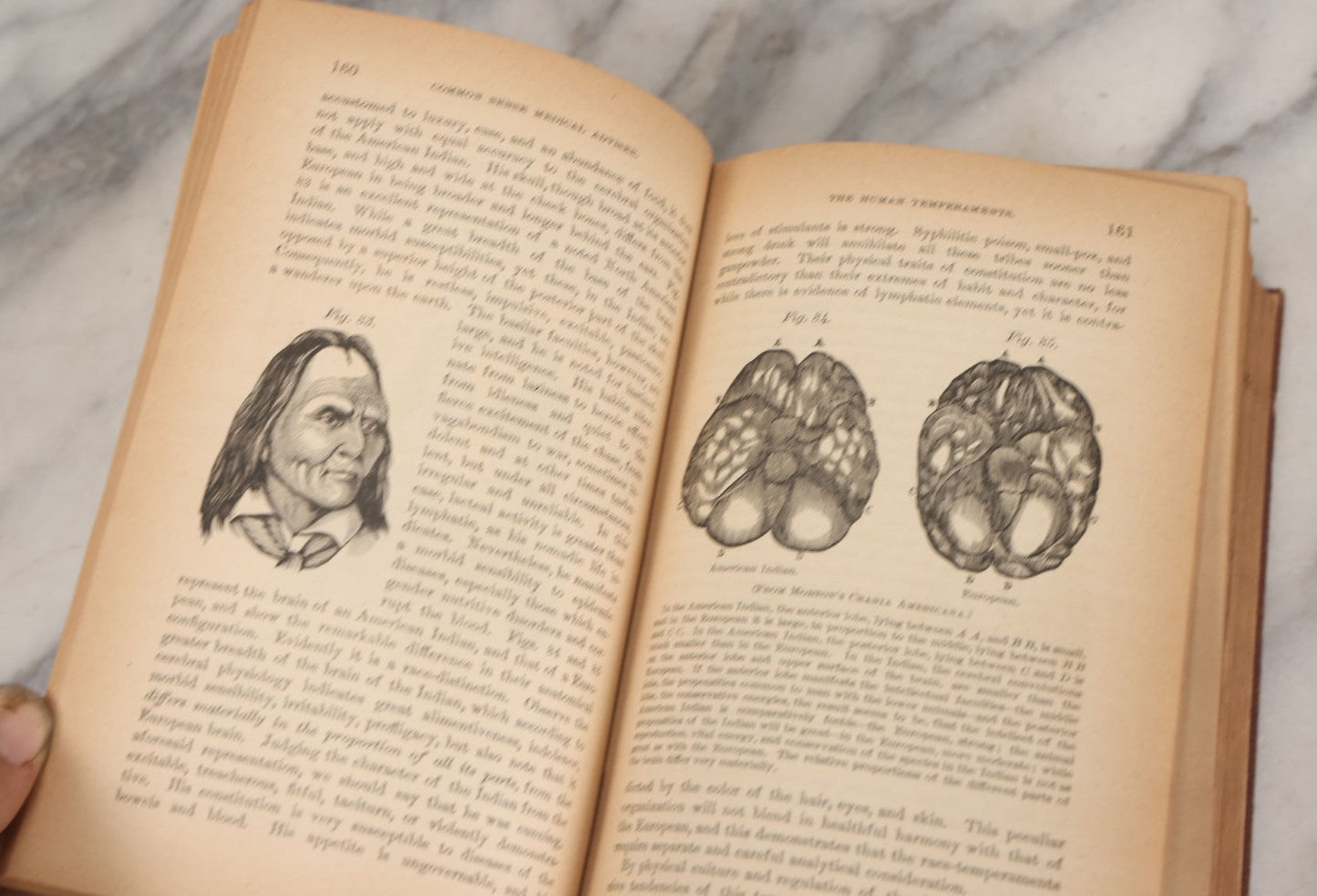 Lot 003 - "The People's Common Sense Medical Adviser In Plain English; Or Medicine Simplified" Antique Book By R.V. Pierce, M.D., 21st Edition, Illustrated, 1889