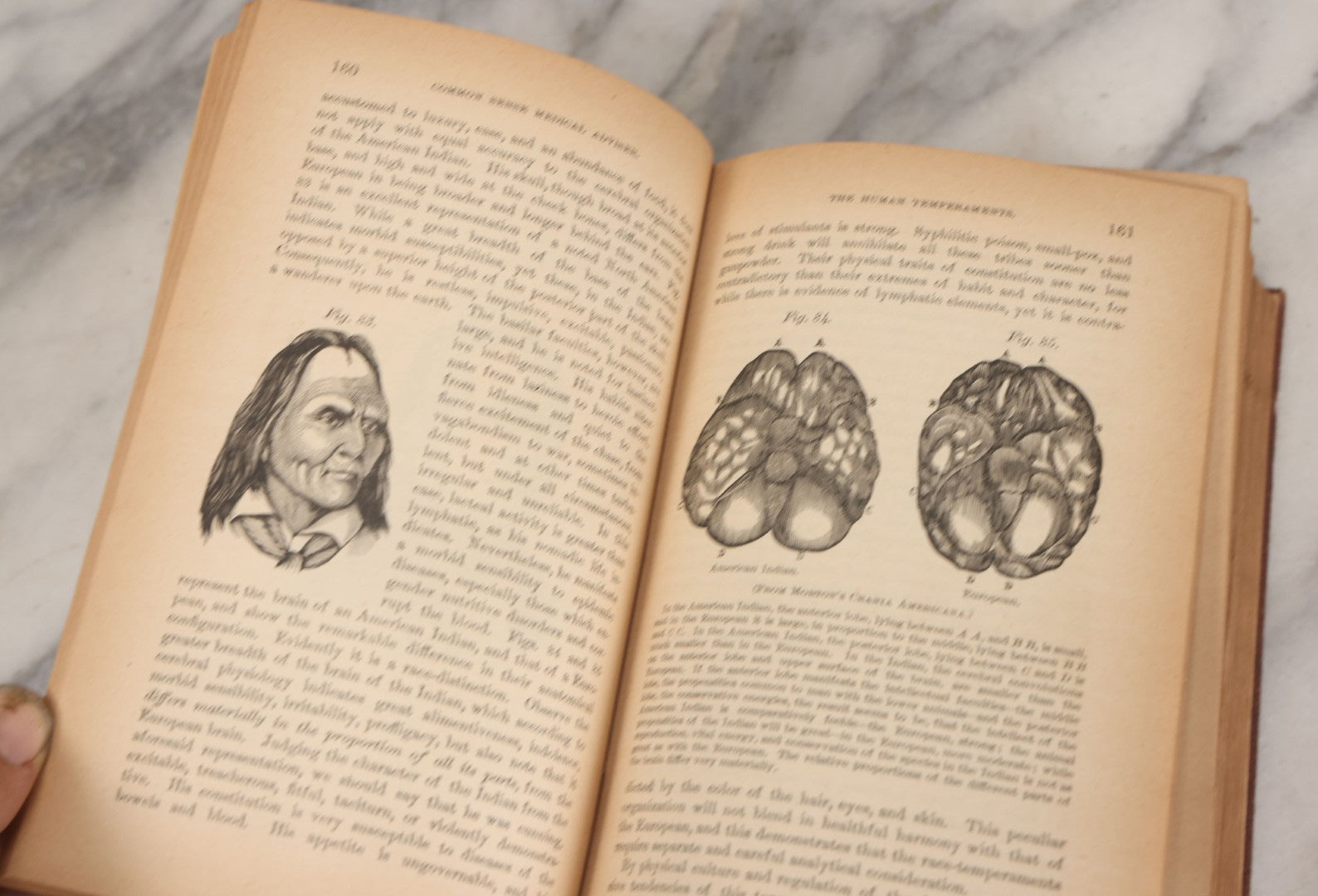 Lot 003 - "The People's Common Sense Medical Adviser In Plain English; Or Medicine Simplified" Antique Book By R.V. Pierce, M.D., 21st Edition, Illustrated, 1889