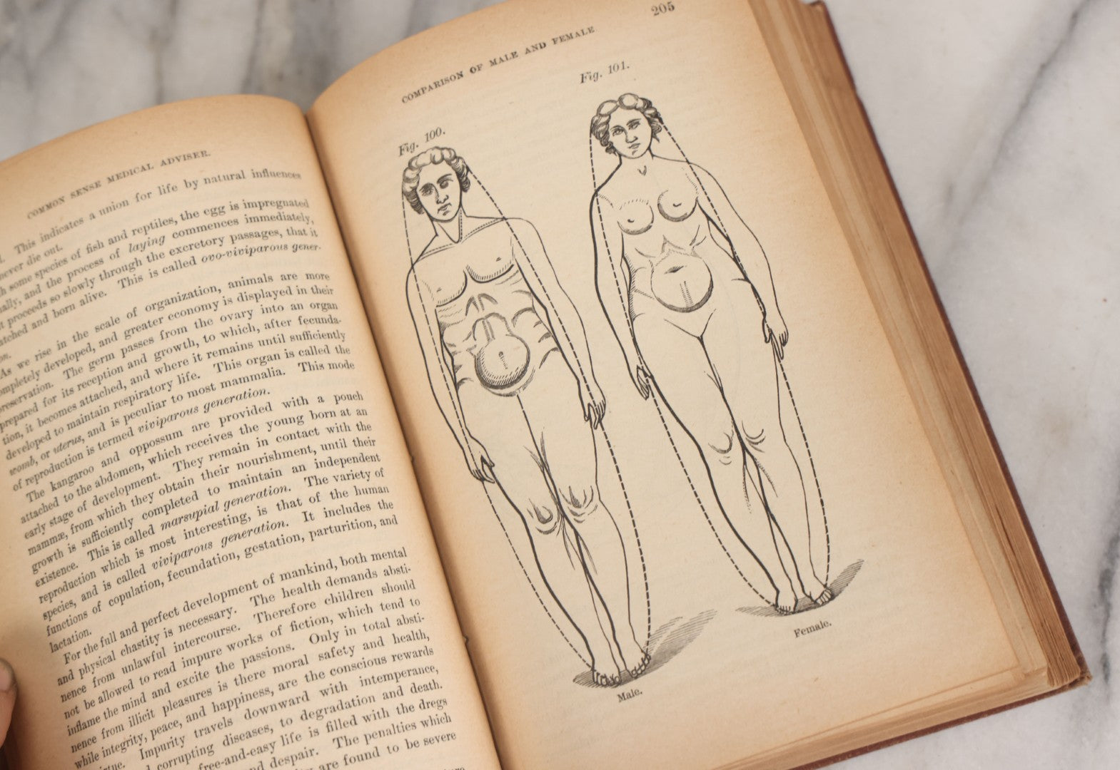 Lot 003 - "The People's Common Sense Medical Adviser In Plain English; Or Medicine Simplified" Antique Book By R.V. Pierce, M.D., 21st Edition, Illustrated, 1889