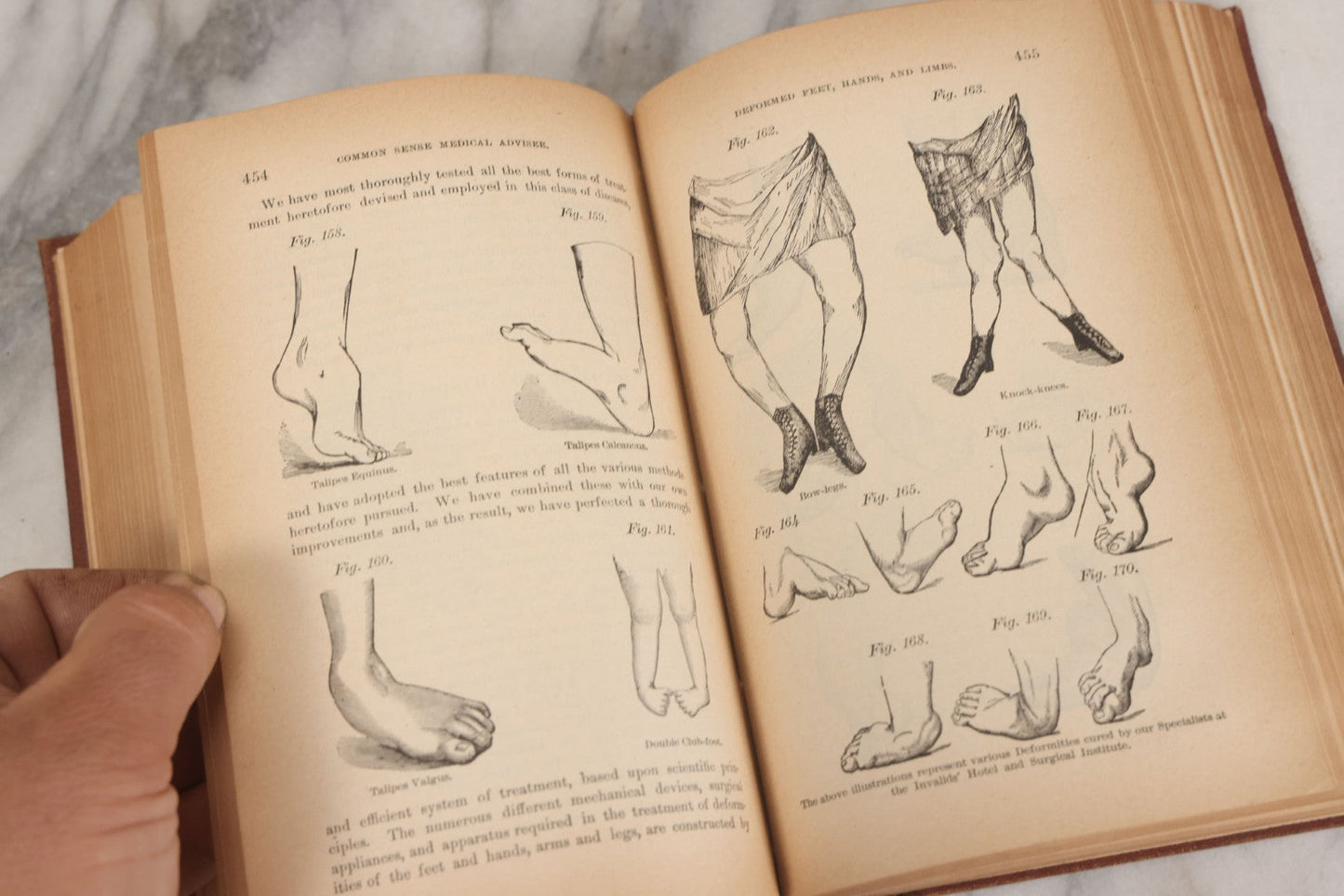 Lot 003 - "The People's Common Sense Medical Adviser In Plain English; Or Medicine Simplified" Antique Book By R.V. Pierce, M.D., 21st Edition, Illustrated, 1889