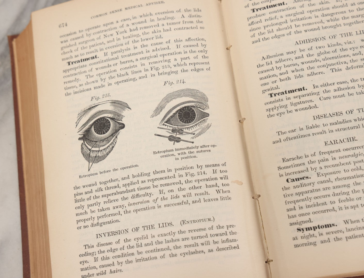 Lot 003 - "The People's Common Sense Medical Adviser In Plain English; Or Medicine Simplified" Antique Book By R.V. Pierce, M.D., 21st Edition, Illustrated, 1889