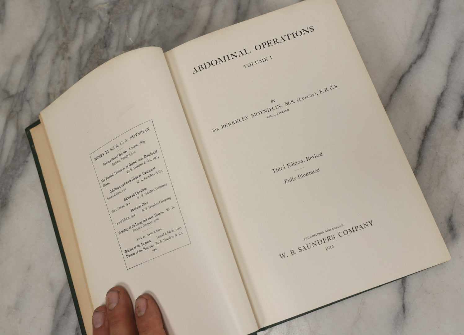Lot 106 - "Abdominal Operations, Volume I" Antique Medical Textbook By Sir Berkeley Moynihan, Third Edition, Revised, Fully Illustrated, W.B. Saunders Company, Publisher, Philadelphia And London, 1914