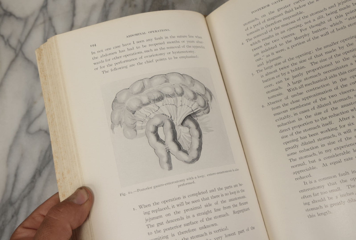 Lot 106 - "Abdominal Operations, Volume I" Antique Medical Textbook By Sir Berkeley Moynihan, Third Edition, Revised, Fully Illustrated, W.B. Saunders Company, Publisher, Philadelphia And London, 1914
