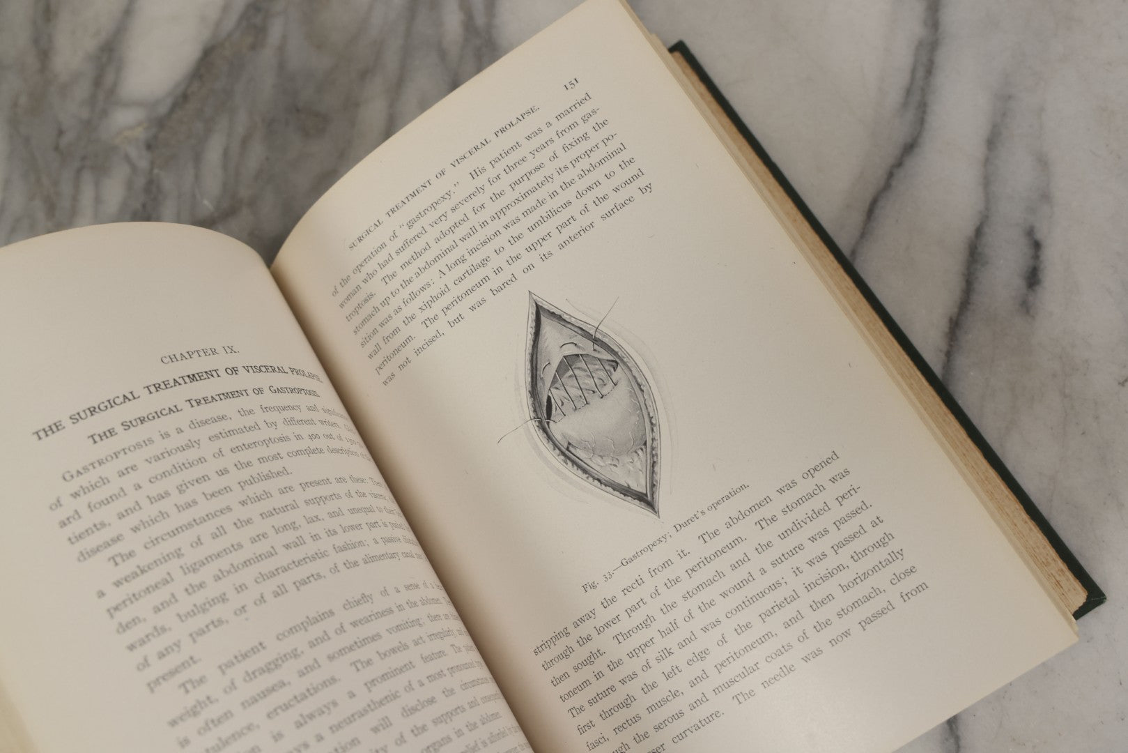 Lot 106 - "Abdominal Operations, Volume I" Antique Medical Textbook By Sir Berkeley Moynihan, Third Edition, Revised, Fully Illustrated, W.B. Saunders Company, Publisher, Philadelphia And London, 1914