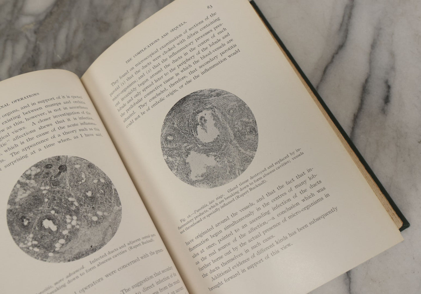 Lot 106 - "Abdominal Operations, Volume I" Antique Medical Textbook By Sir Berkeley Moynihan, Third Edition, Revised, Fully Illustrated, W.B. Saunders Company, Publisher, Philadelphia And London, 1914