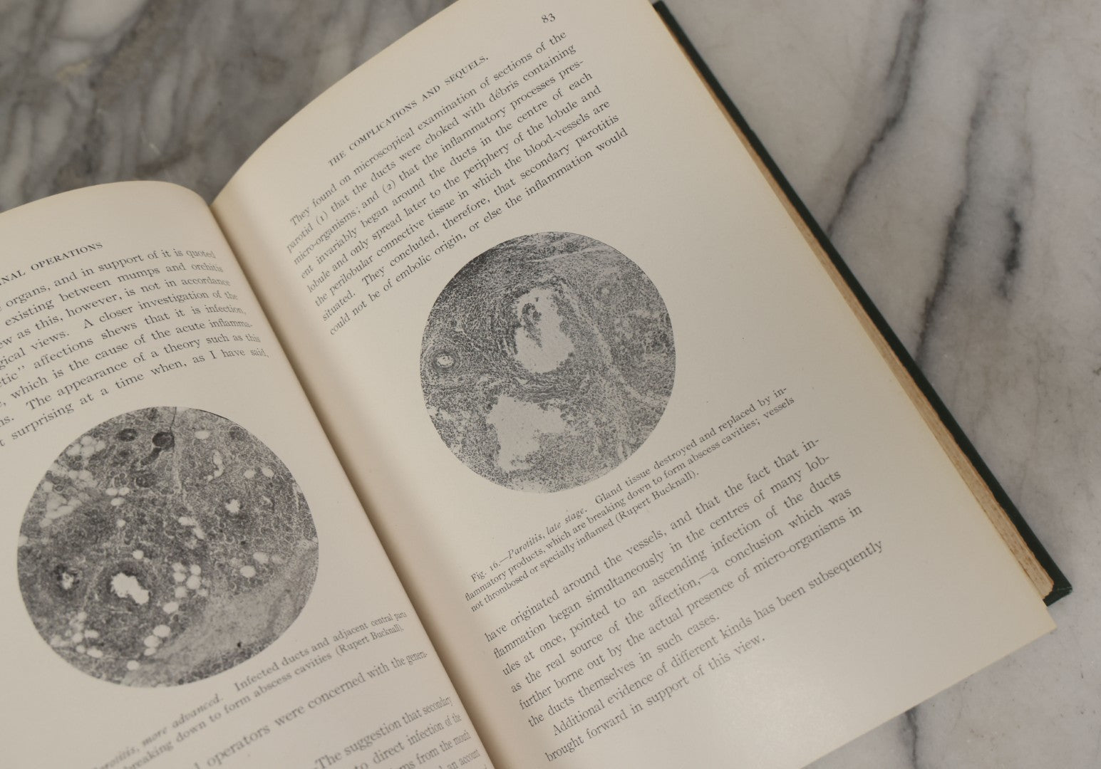 Lot 106 - "Abdominal Operations, Volume I" Antique Medical Textbook By Sir Berkeley Moynihan, Third Edition, Revised, Fully Illustrated, W.B. Saunders Company, Publisher, Philadelphia And London, 1914