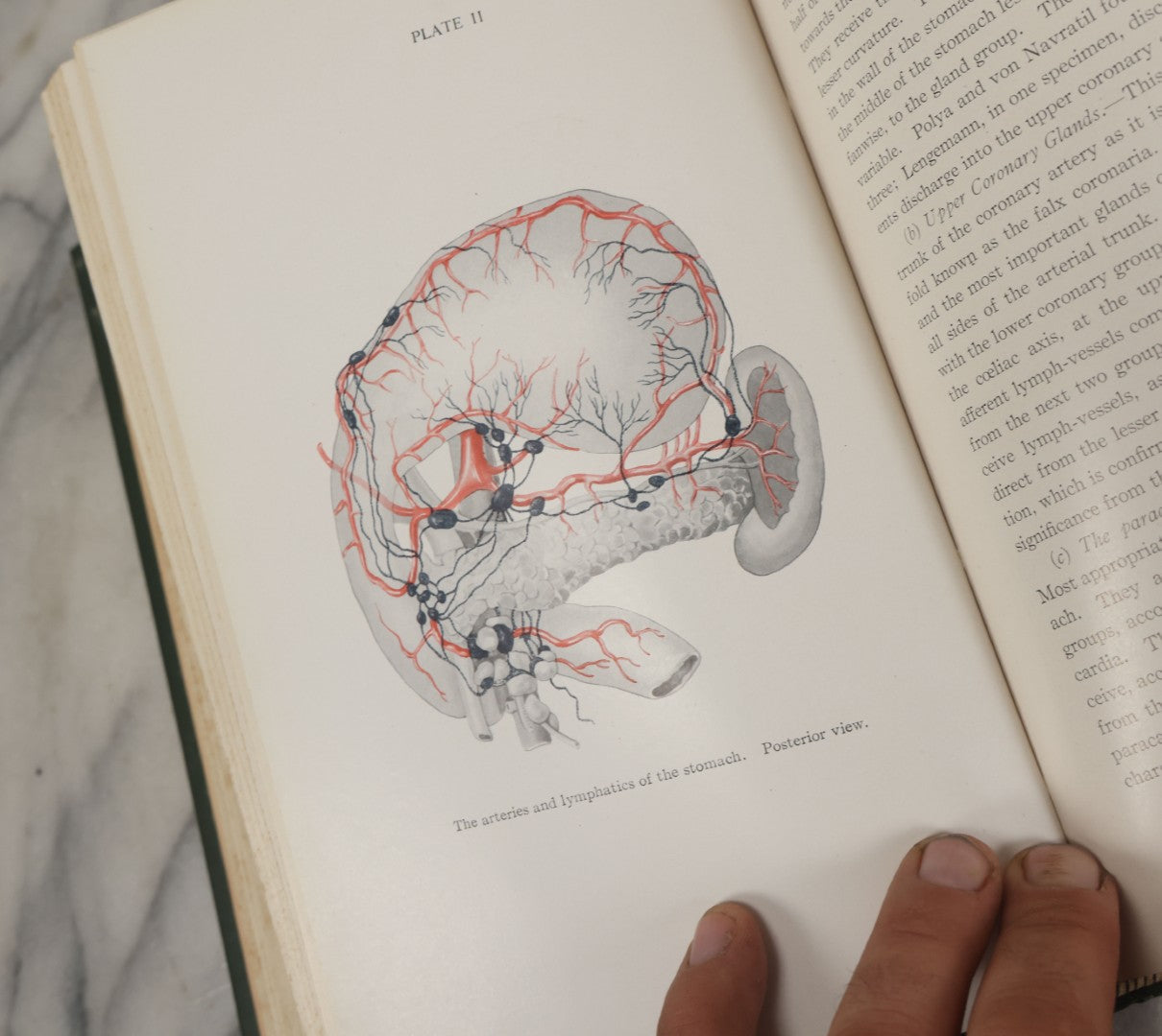 Lot 106 - "Abdominal Operations, Volume I" Antique Medical Textbook By Sir Berkeley Moynihan, Third Edition, Revised, Fully Illustrated, W.B. Saunders Company, Publisher, Philadelphia And London, 1914
