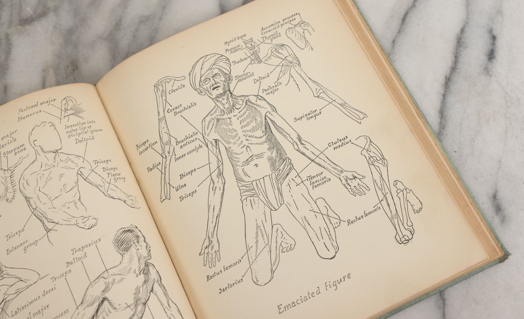 Lot 061 - "Anatomy And Drawing" Vintage Book By Victor Perard With Over One Thousand Illustrations Published By The Author, Third Edition, Fourth Printing, 1940