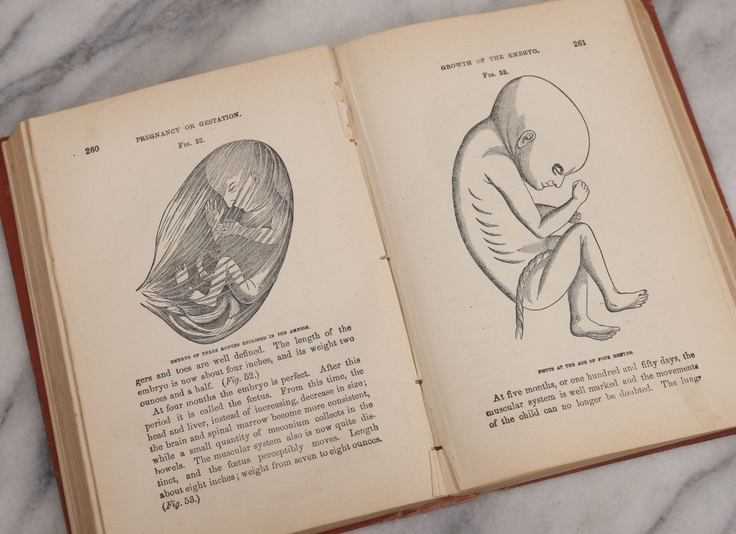 Lot 106 - "The Ladies Medical Guide" Antique Book By S. Pancoast, M.D., Illustrated With Over 100 Engravings, John E. Potter And Company, Publishers, Philadelphia, 1875