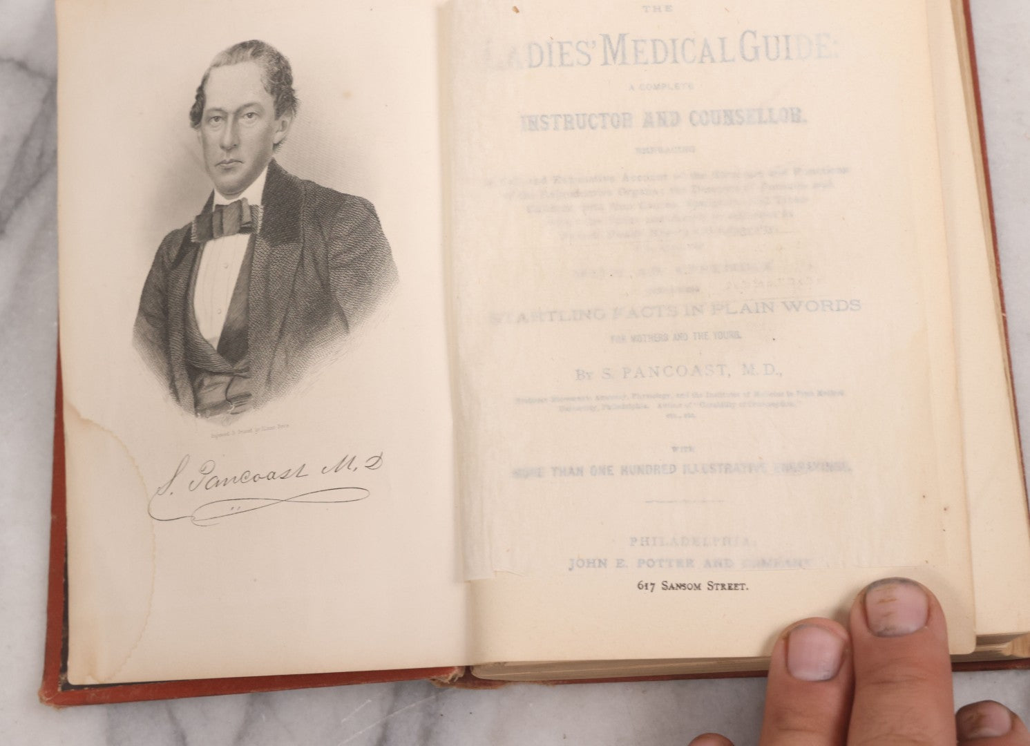 Lot 106 - "The Ladies Medical Guide" Antique Book By S. Pancoast, M.D., Illustrated With Over 100 Engravings, John E. Potter And Company, Publishers, Philadelphia, 1875