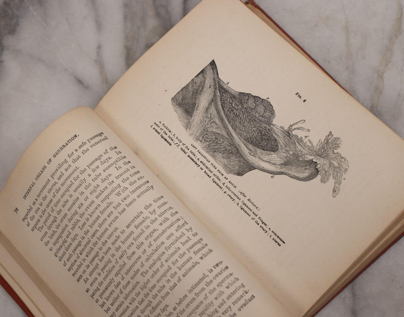 Lot 106 - "The Ladies Medical Guide" Antique Book By S. Pancoast, M.D., Illustrated With Over 100 Engravings, John E. Potter And Company, Publishers, Philadelphia, 1875