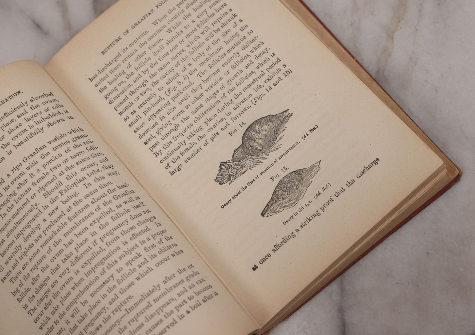 Lot 106 - "The Ladies Medical Guide" Antique Book By S. Pancoast, M.D., Illustrated With Over 100 Engravings, John E. Potter And Company, Publishers, Philadelphia, 1875