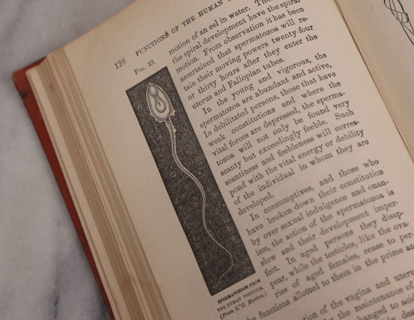 Lot 106 - "The Ladies Medical Guide" Antique Book By S. Pancoast, M.D., Illustrated With Over 100 Engravings, John E. Potter And Company, Publishers, Philadelphia, 1875
