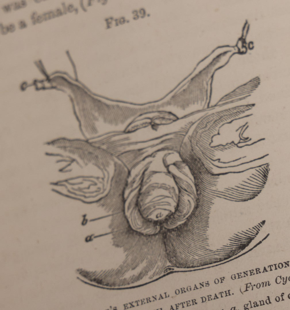 Lot 106 - "The Ladies Medical Guide" Antique Book By S. Pancoast, M.D., Illustrated With Over 100 Engravings, John E. Potter And Company, Publishers, Philadelphia, 1875