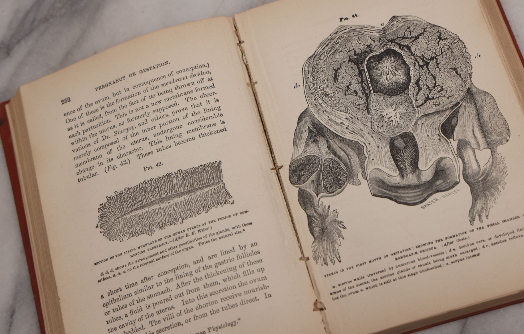 Lot 106 - "The Ladies Medical Guide" Antique Book By S. Pancoast, M.D., Illustrated With Over 100 Engravings, John E. Potter And Company, Publishers, Philadelphia, 1875