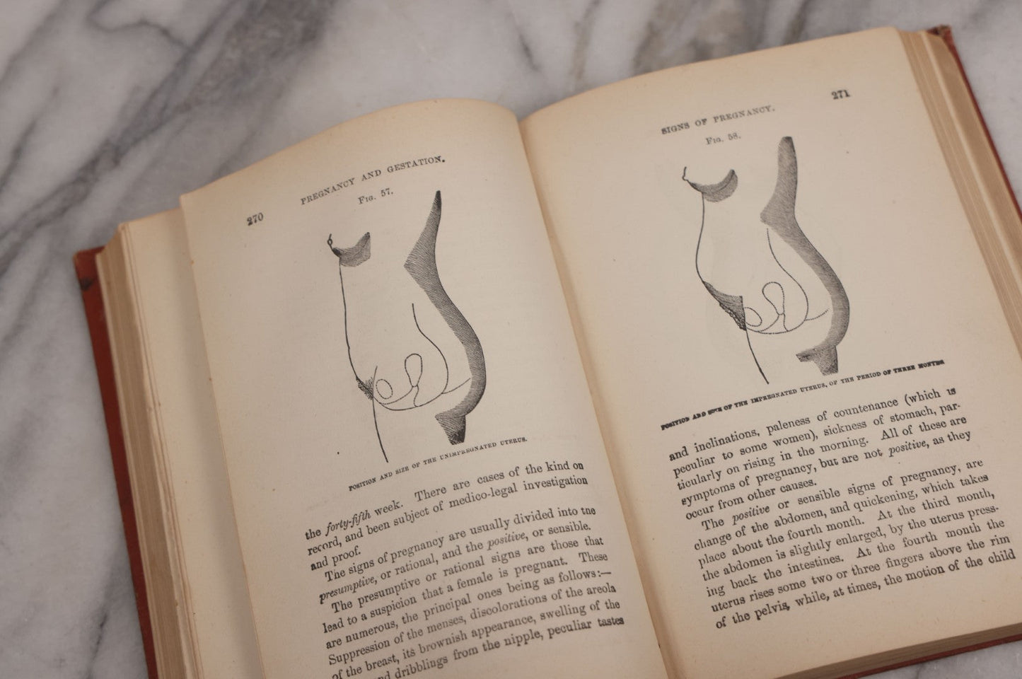 Lot 106 - "The Ladies Medical Guide" Antique Book By S. Pancoast, M.D., Illustrated With Over 100 Engravings, John E. Potter And Company, Publishers, Philadelphia, 1875