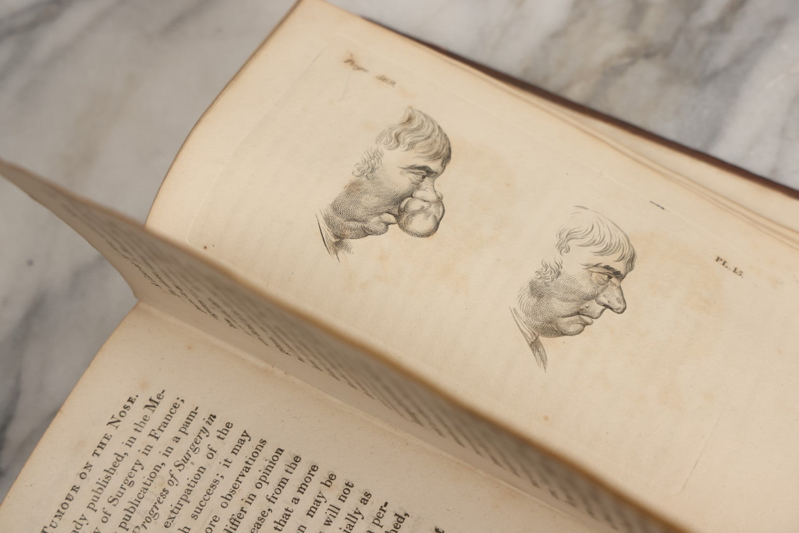 Lot 025 - "Practical Observations In Surgery, Illustrated By Cases" Early Antique Medical Surgery  Book By William Hey, Second Edition, Illustrated With Plates, T. Cadell And W. Davies, Publishers, London, 1810
