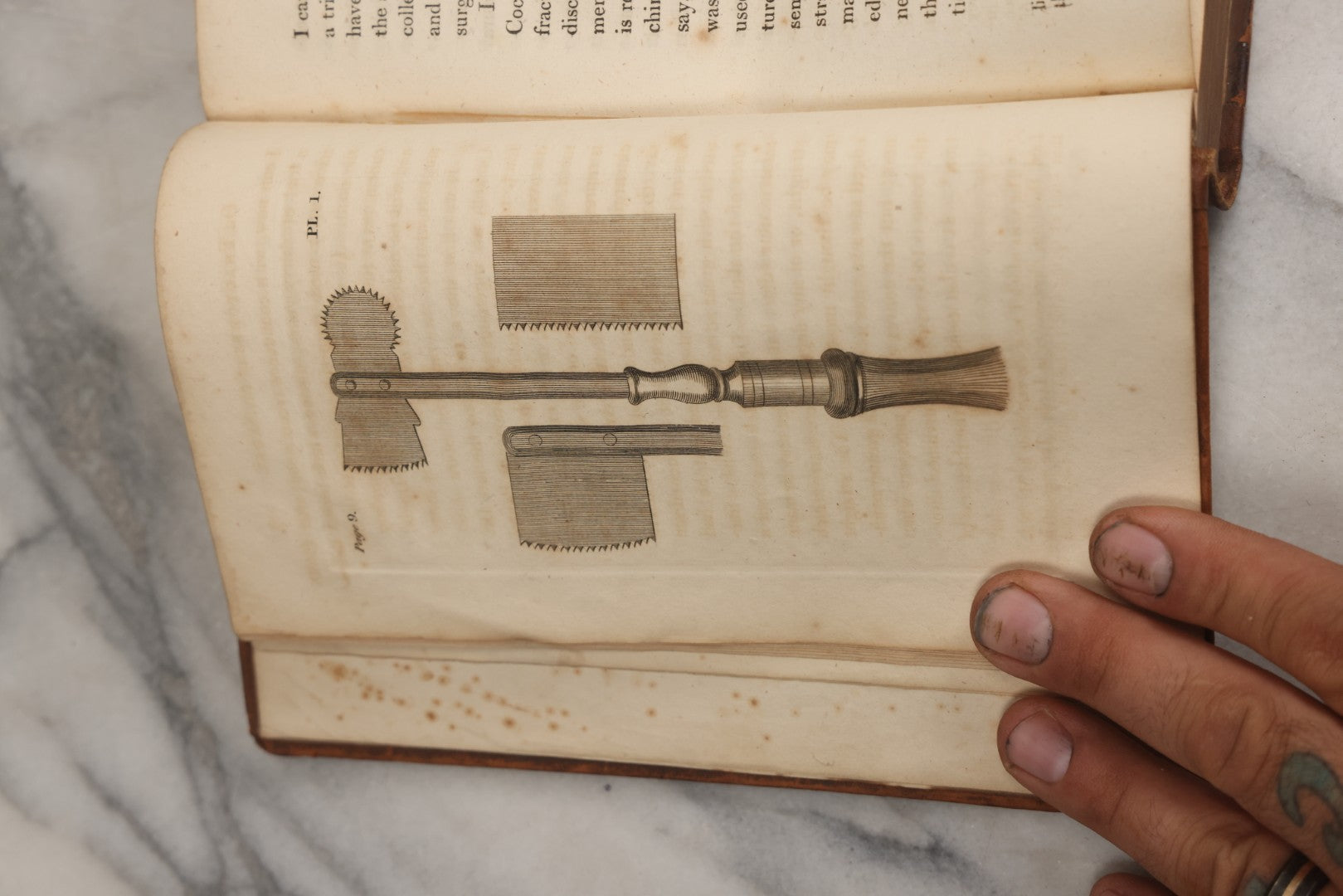 Lot 025 - "Practical Observations In Surgery, Illustrated By Cases" Early Antique Medical Surgery  Book By William Hey, Second Edition, Illustrated With Plates, T. Cadell And W. Davies, Publishers, London, 1810