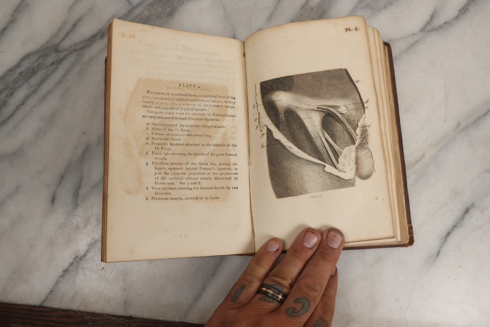 Lot 025 - "Practical Observations In Surgery, Illustrated By Cases" Early Antique Medical Surgery  Book By William Hey, Second Edition, Illustrated With Plates, T. Cadell And W. Davies, Publishers, London, 1810