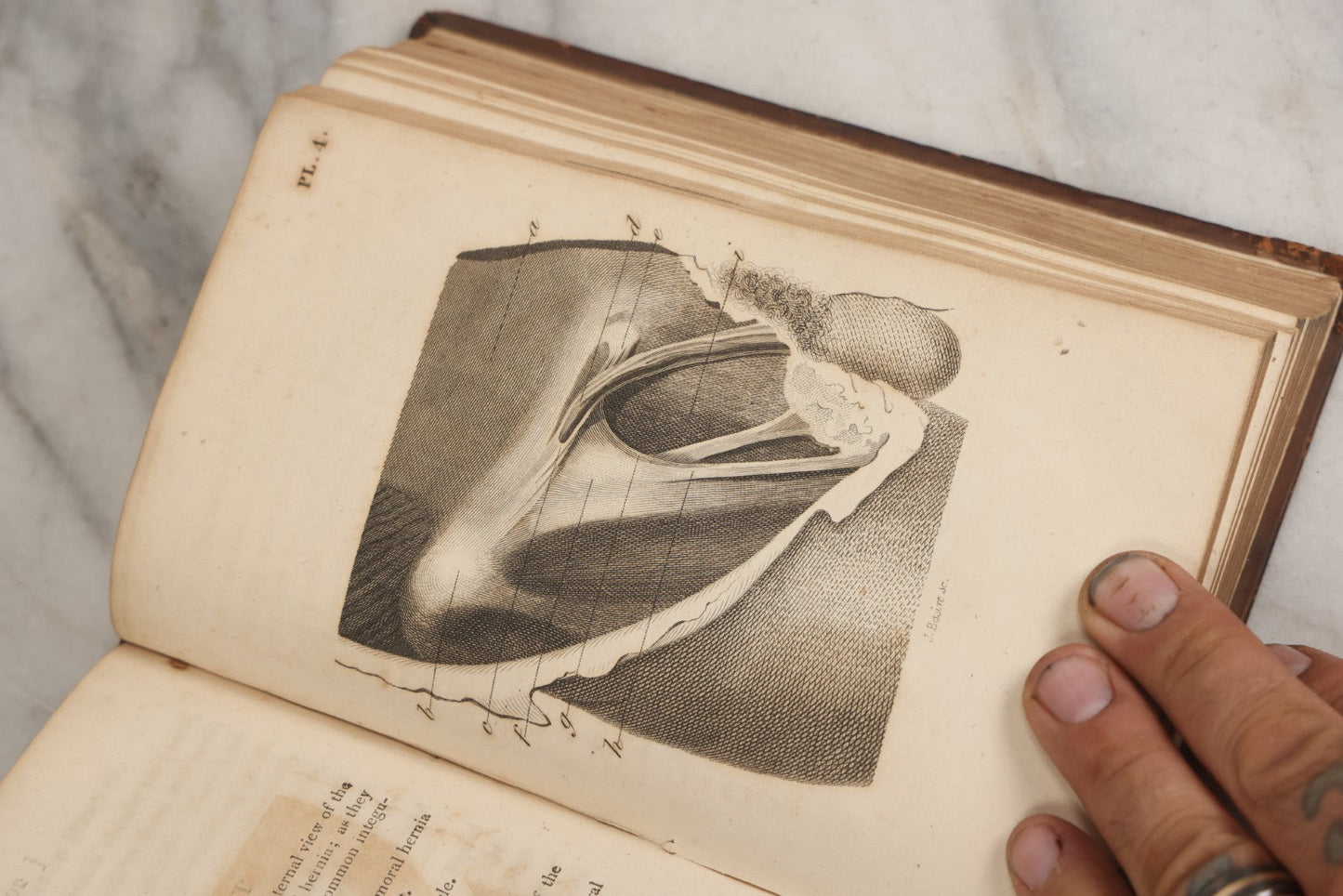 Lot 025 - "Practical Observations In Surgery, Illustrated By Cases" Early Antique Medical Surgery  Book By William Hey, Second Edition, Illustrated With Plates, T. Cadell And W. Davies, Publishers, London, 1810