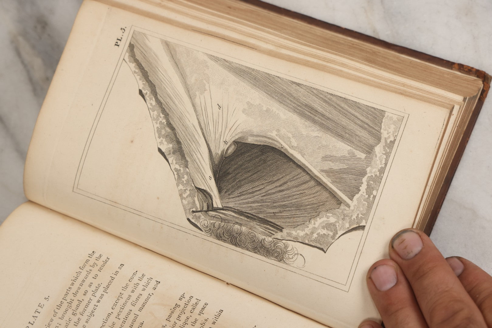 Lot 025 - "Practical Observations In Surgery, Illustrated By Cases" Early Antique Medical Surgery  Book By William Hey, Second Edition, Illustrated With Plates, T. Cadell And W. Davies, Publishers, London, 1810