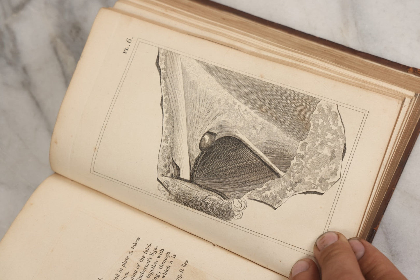 Lot 025 - "Practical Observations In Surgery, Illustrated By Cases" Early Antique Medical Surgery  Book By William Hey, Second Edition, Illustrated With Plates, T. Cadell And W. Davies, Publishers, London, 1810
