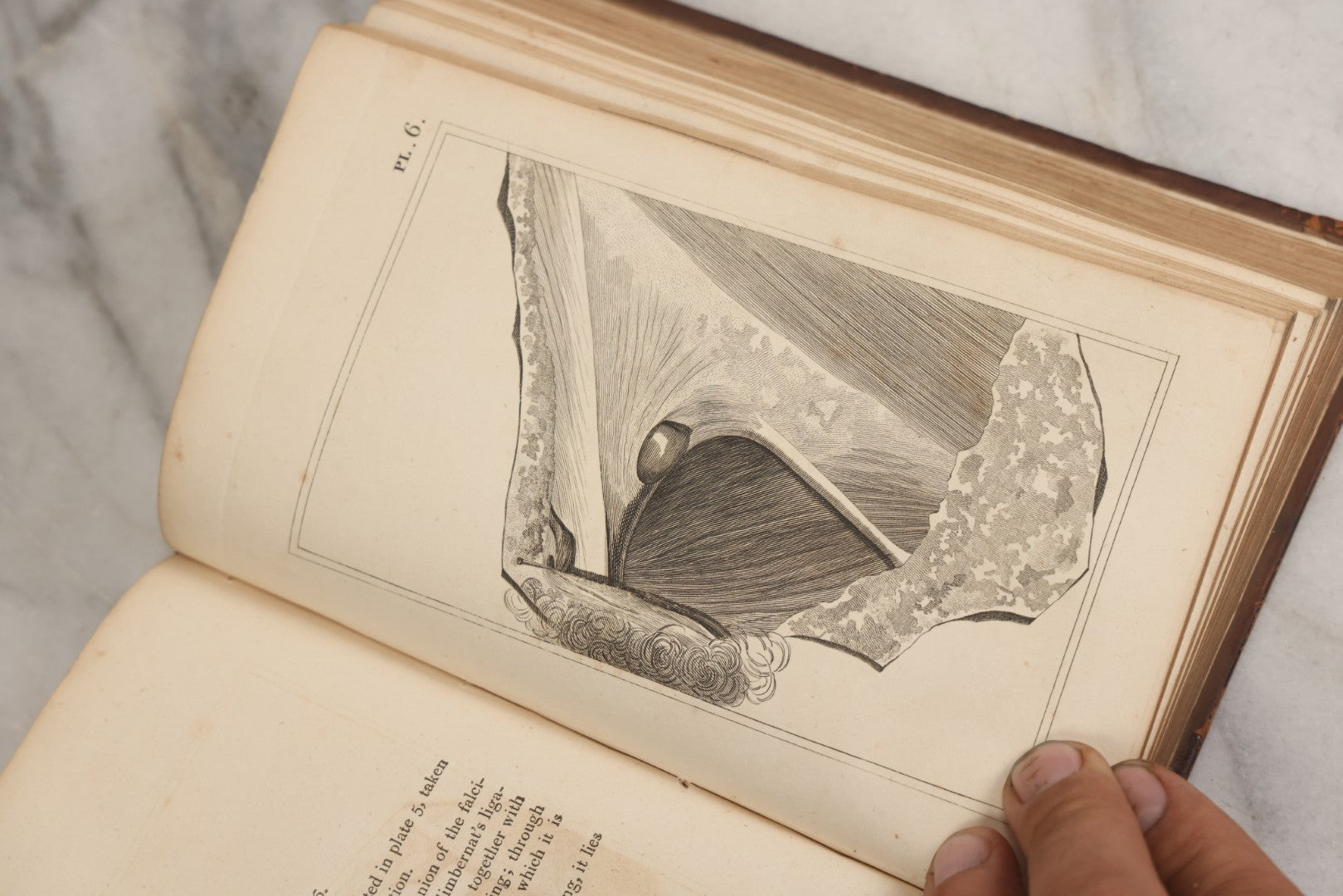 Lot 025 - "Practical Observations In Surgery, Illustrated By Cases" Early Antique Medical Surgery  Book By William Hey, Second Edition, Illustrated With Plates, T. Cadell And W. Davies, Publishers, London, 1810