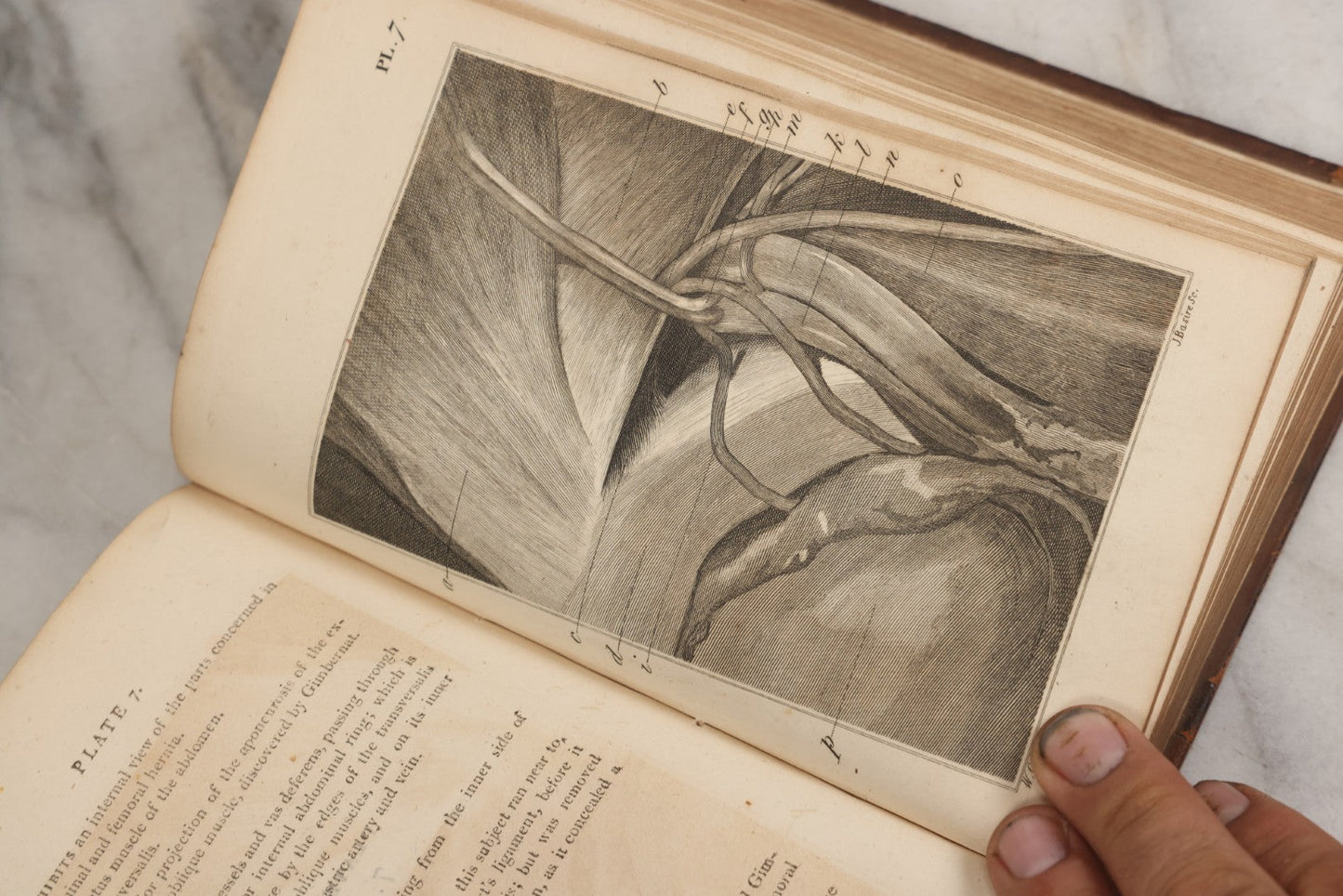 Lot 025 - "Practical Observations In Surgery, Illustrated By Cases" Early Antique Medical Surgery  Book By William Hey, Second Edition, Illustrated With Plates, T. Cadell And W. Davies, Publishers, London, 1810