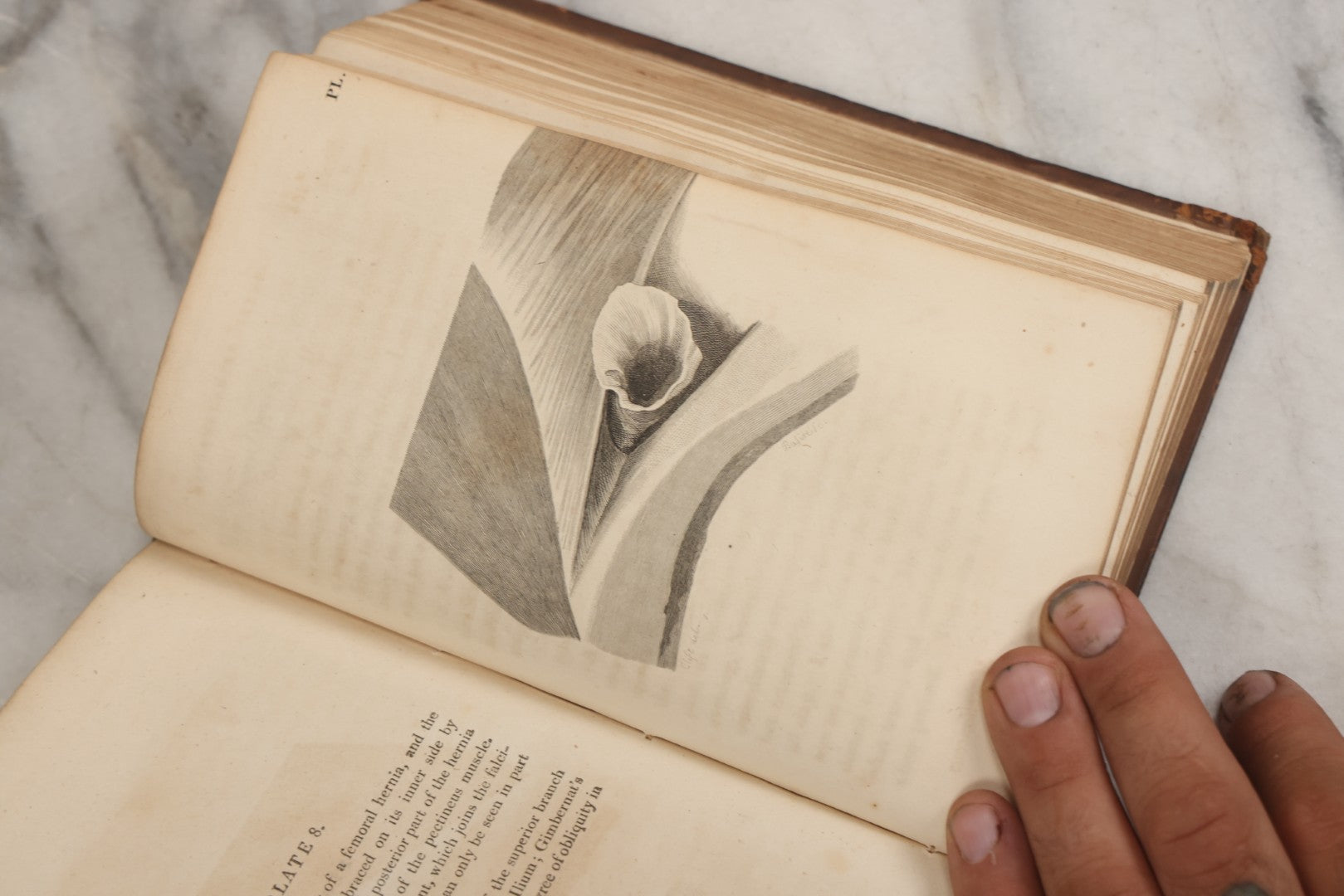 Lot 025 - "Practical Observations In Surgery, Illustrated By Cases" Early Antique Medical Surgery  Book By William Hey, Second Edition, Illustrated With Plates, T. Cadell And W. Davies, Publishers, London, 1810