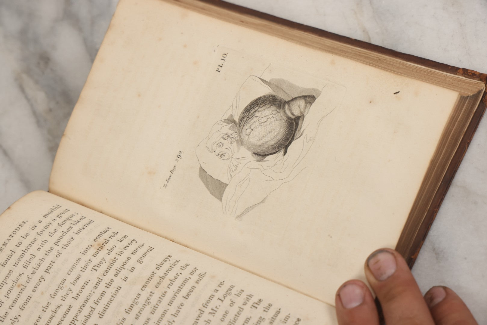 Lot 025 - "Practical Observations In Surgery, Illustrated By Cases" Early Antique Medical Surgery  Book By William Hey, Second Edition, Illustrated With Plates, T. Cadell And W. Davies, Publishers, London, 1810