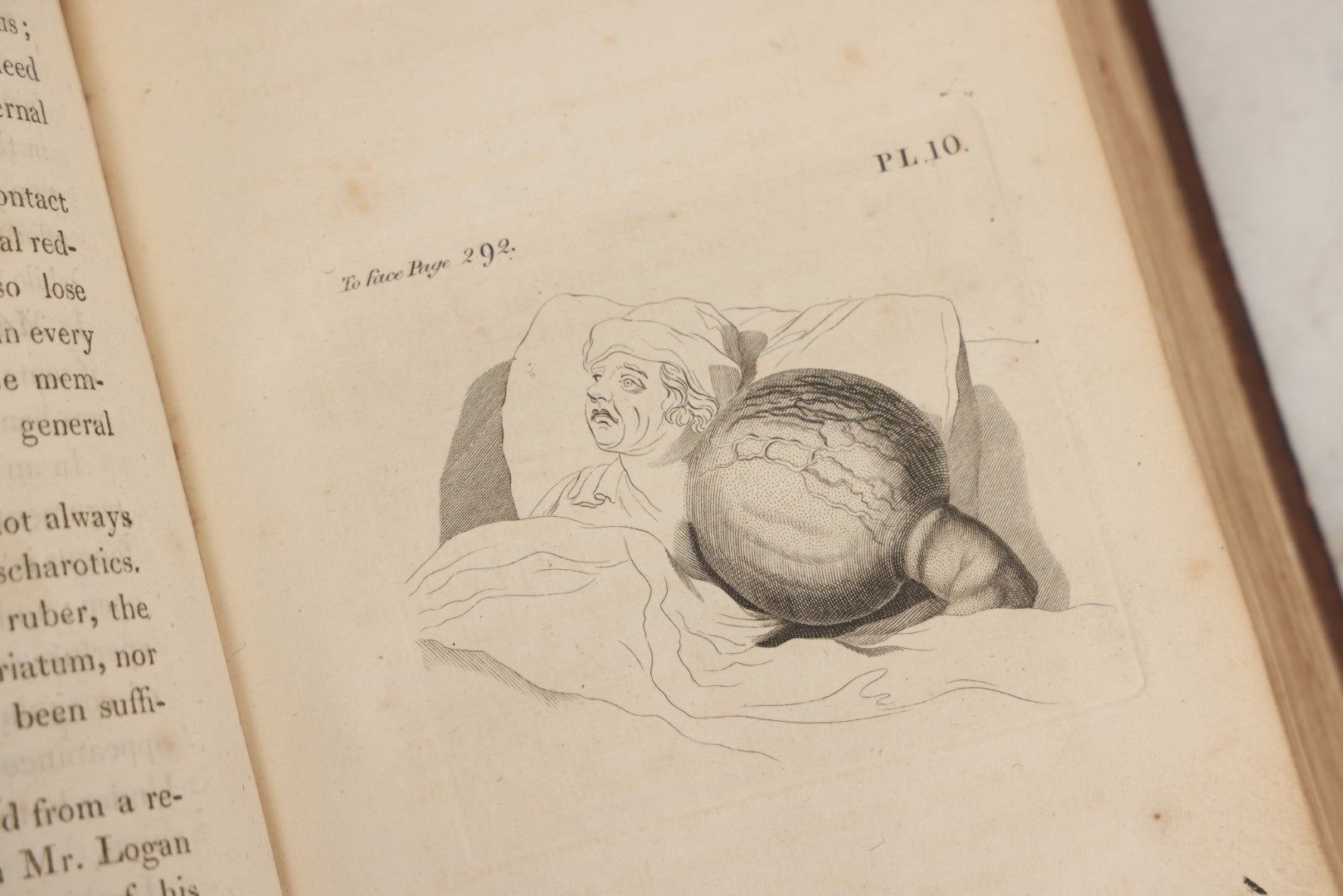 Lot 025 - "Practical Observations In Surgery, Illustrated By Cases" Early Antique Medical Surgery  Book By William Hey, Second Edition, Illustrated With Plates, T. Cadell And W. Davies, Publishers, London, 1810