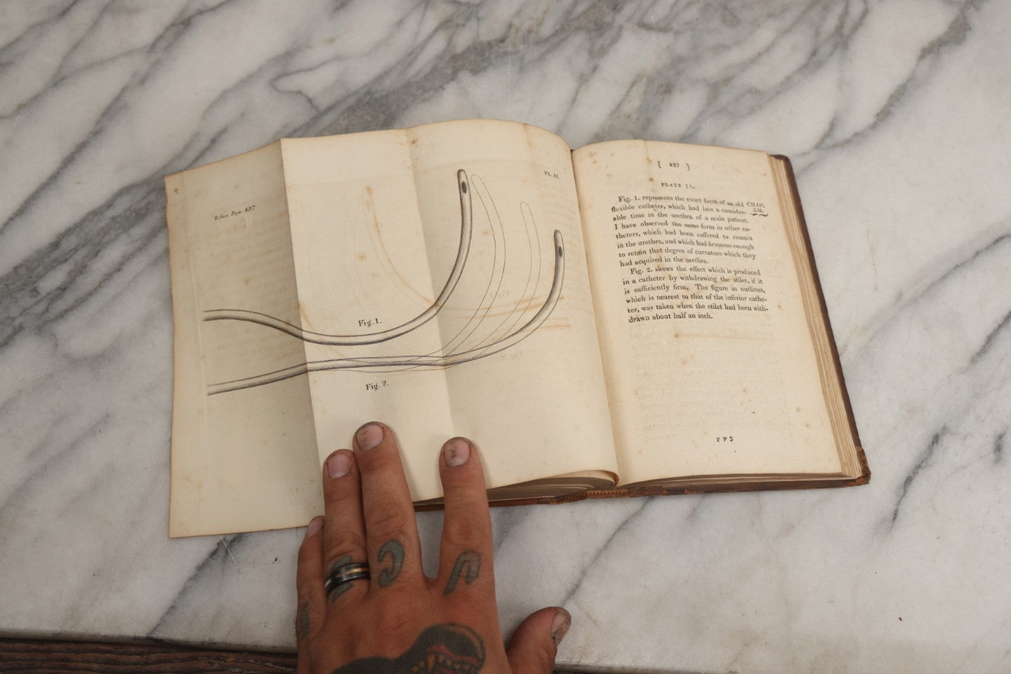 Lot 025 - "Practical Observations In Surgery, Illustrated By Cases" Early Antique Medical Surgery  Book By William Hey, Second Edition, Illustrated With Plates, T. Cadell And W. Davies, Publishers, London, 1810