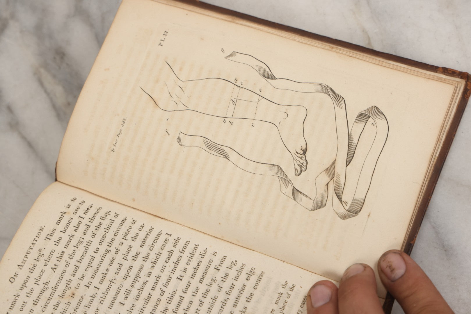 Lot 025 - "Practical Observations In Surgery, Illustrated By Cases" Early Antique Medical Surgery  Book By William Hey, Second Edition, Illustrated With Plates, T. Cadell And W. Davies, Publishers, London, 1810