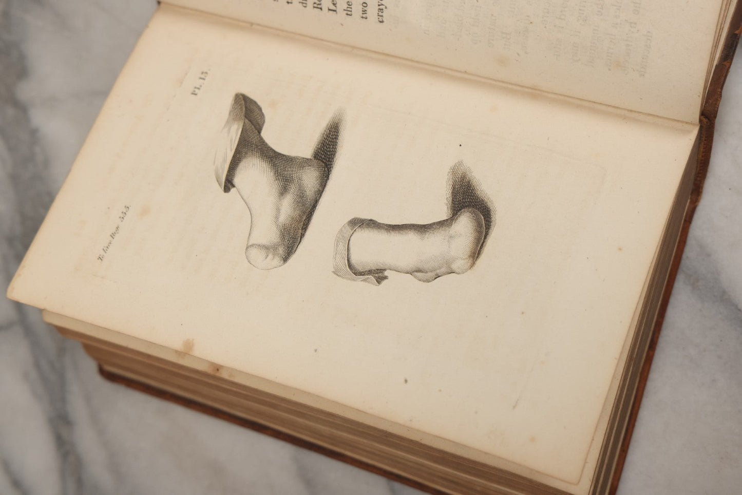 Lot 025 - "Practical Observations In Surgery, Illustrated By Cases" Early Antique Medical Surgery  Book By William Hey, Second Edition, Illustrated With Plates, T. Cadell And W. Davies, Publishers, London, 1810