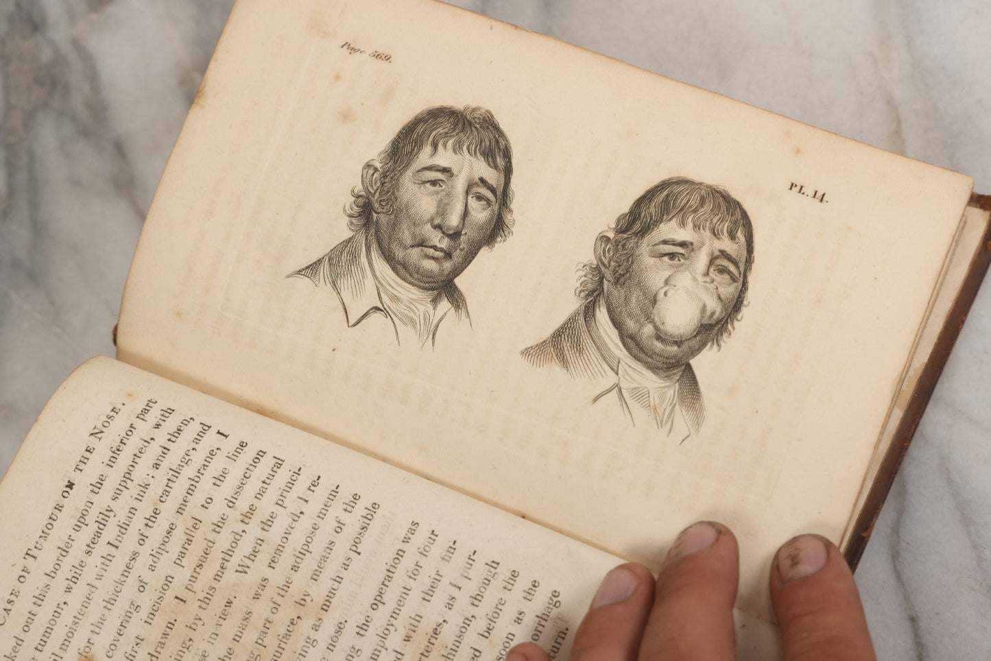 Lot 025 - "Practical Observations In Surgery, Illustrated By Cases" Early Antique Medical Surgery  Book By William Hey, Second Edition, Illustrated With Plates, T. Cadell And W. Davies, Publishers, London, 1810