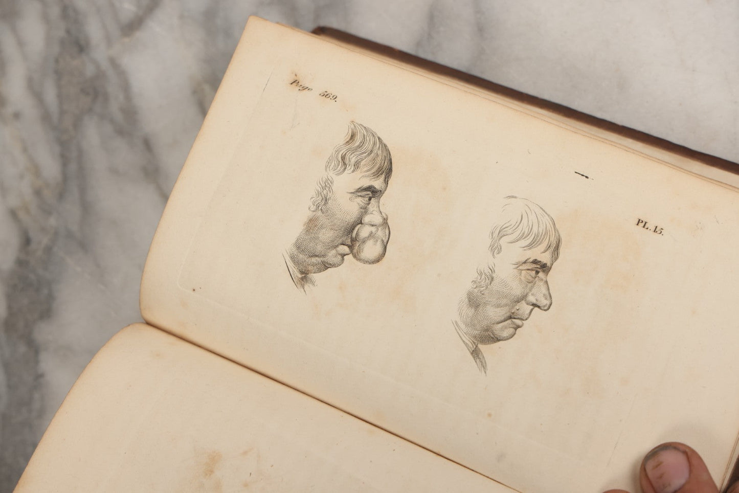 Lot 025 - "Practical Observations In Surgery, Illustrated By Cases" Early Antique Medical Surgery  Book By William Hey, Second Edition, Illustrated With Plates, T. Cadell And W. Davies, Publishers, London, 1810