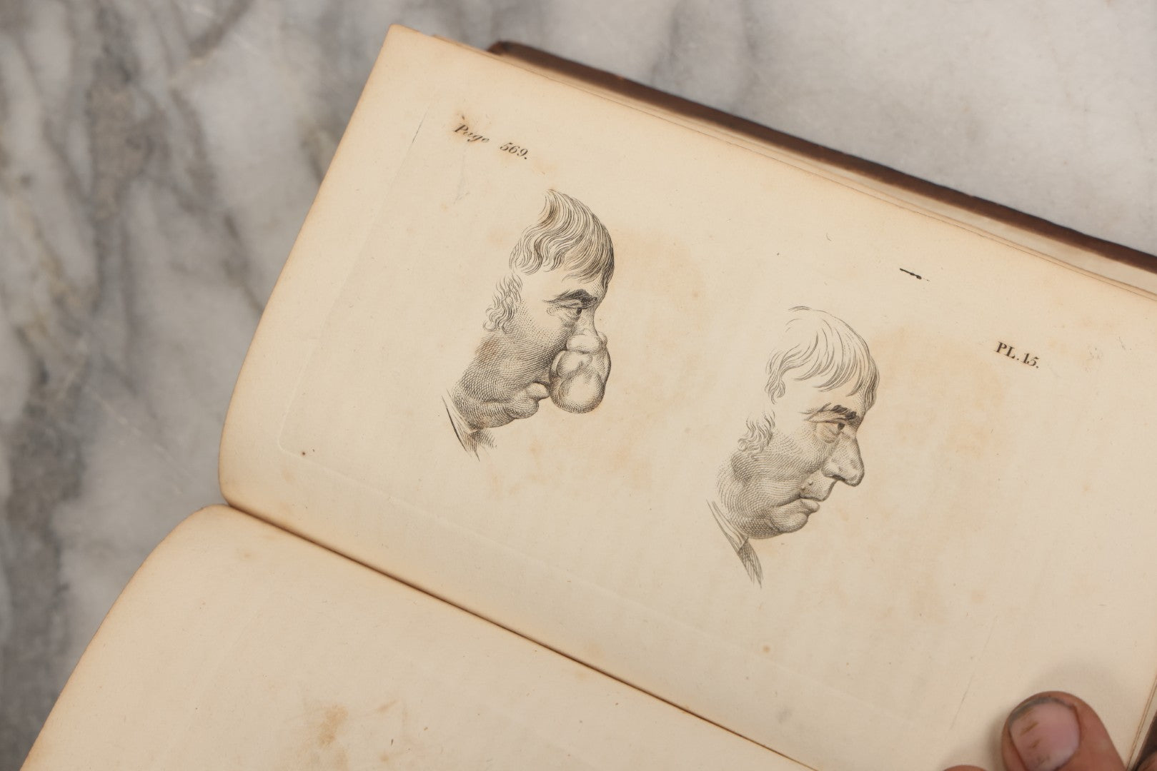 Lot 025 - "Practical Observations In Surgery, Illustrated By Cases" Early Antique Medical Surgery  Book By William Hey, Second Edition, Illustrated With Plates, T. Cadell And W. Davies, Publishers, London, 1810