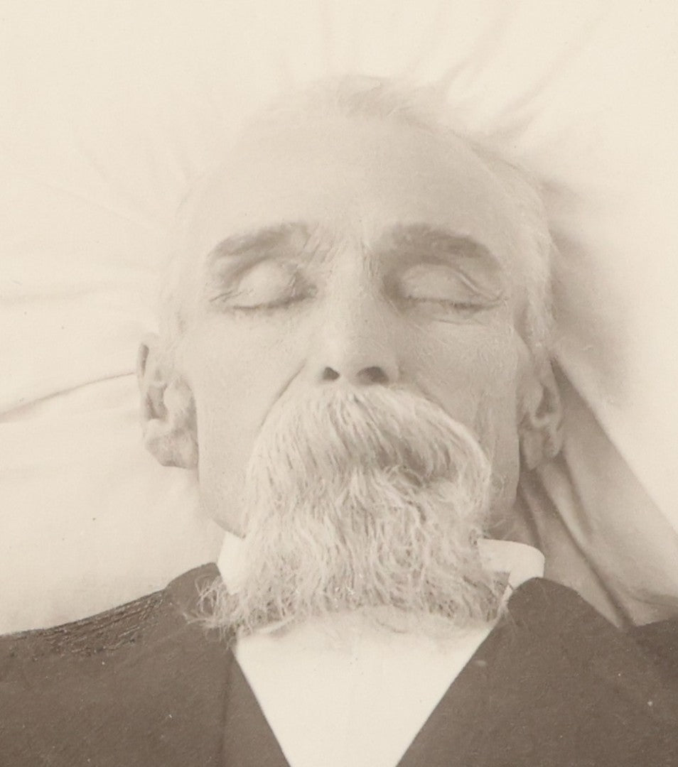 Lot 027 - Pair Of Antique Boarded Photographs Of Dr. Julius Benson Evans In Life And Death, Including Occupational Photo Of Doctor With Bag, And Post Mortem Photo Of Deceased Doctor Lying At Rest