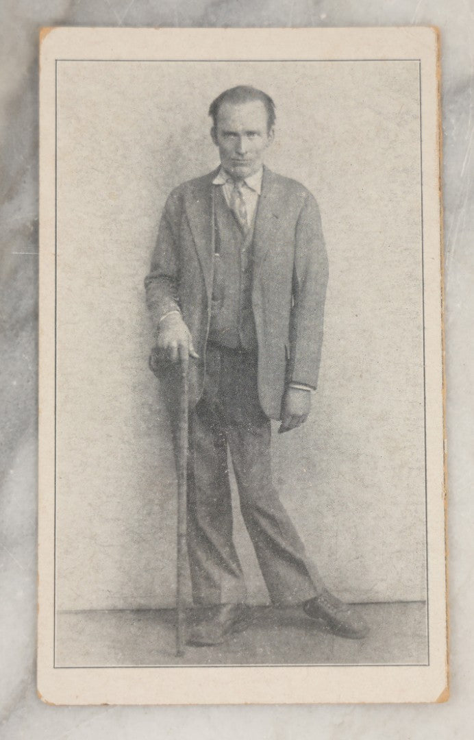Lot 247 - Antique Charity Solicitation Card With Photo Of A Bow-Legged Man With Cane, Info On Verso Indicates Born In Lancaster, December 17, 1902, Died In Bertrand Hospital, November 18, 1942