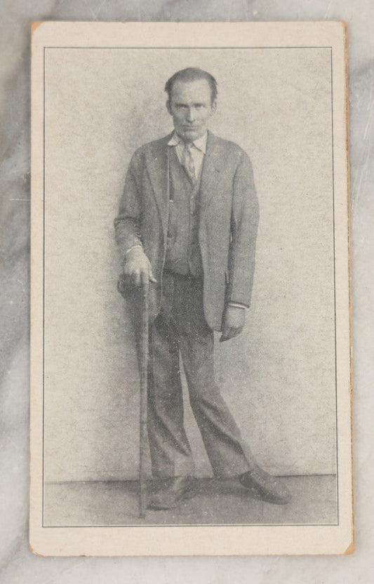 Lot 247 - Antique Charity Solicitation Card With Photo Of A Bow-Legged Man With Cane, Info On Verso Indicates Born In Lancaster, December 17, 1902, Died In Bertrand Hospital, November 18, 1942