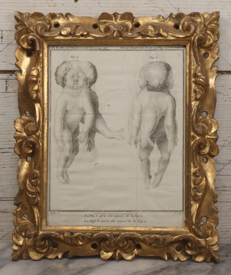 Lot 015 - Antique Anatomical Engraving Of Conjoined Twins, From Mémoires De L'Académie Royale Des Sciences, Paris, 1776, After Drawings By Fossier (Del.) And Engraved By Y. Le G. (Sc.), French Medical Illustration, Framed, 9-5/8" x 11-5/8"