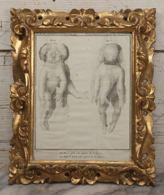 Lot 015 - Antique Anatomical Engraving Of Conjoined Twins, From Mémoires De L'Académie Royale Des Sciences, Paris, 1776, After Drawings By Fossier (Del.) And Engraved By Y. Le G. (Sc.), French Medical Illustration, Framed, 9-5/8" x 11-5/8"