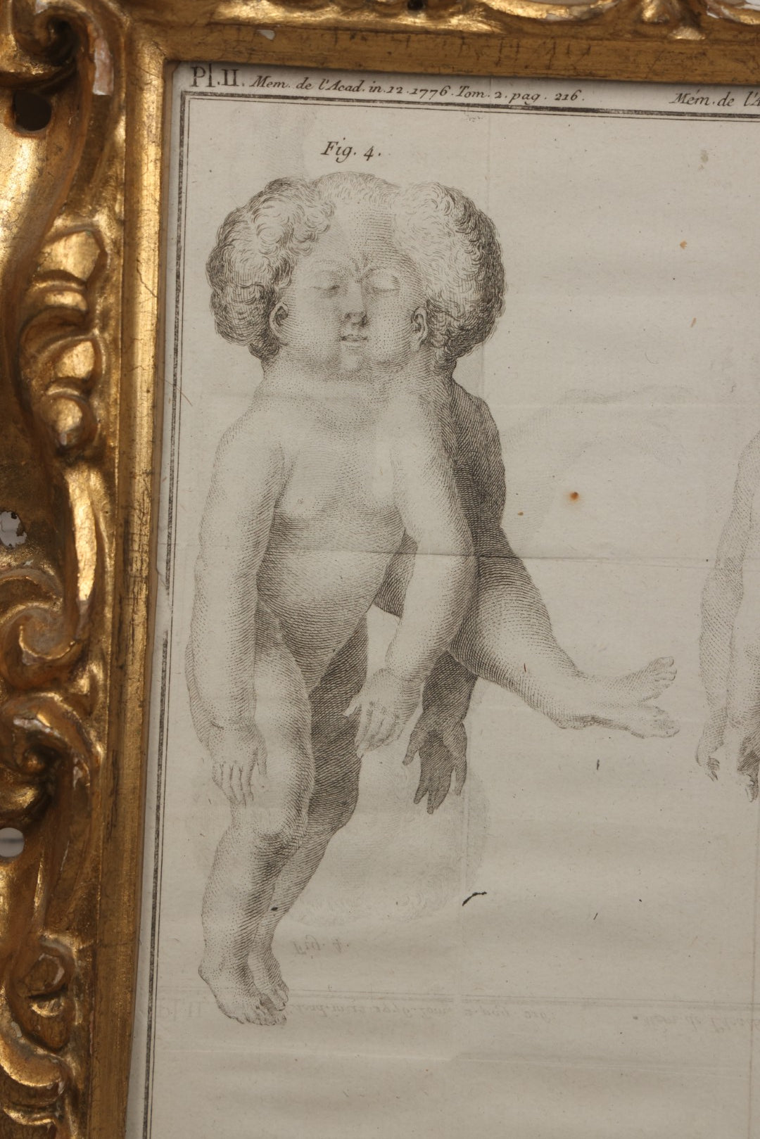 Lot 015 - Antique Anatomical Engraving Of Conjoined Twins, From Mémoires De L'Académie Royale Des Sciences, Paris, 1776, After Drawings By Fossier (Del.) And Engraved By Y. Le G. (Sc.), French Medical Illustration, Framed, 9-5/8" x 11-5/8"